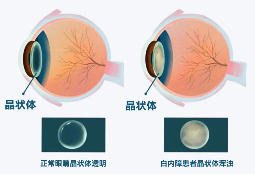 07cbe503-f6f6-48f5-947e-4a95c8e4d1e2.jpg